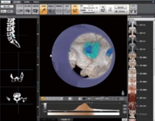 コニカミノルタ：内視鏡手術のシミュレーション